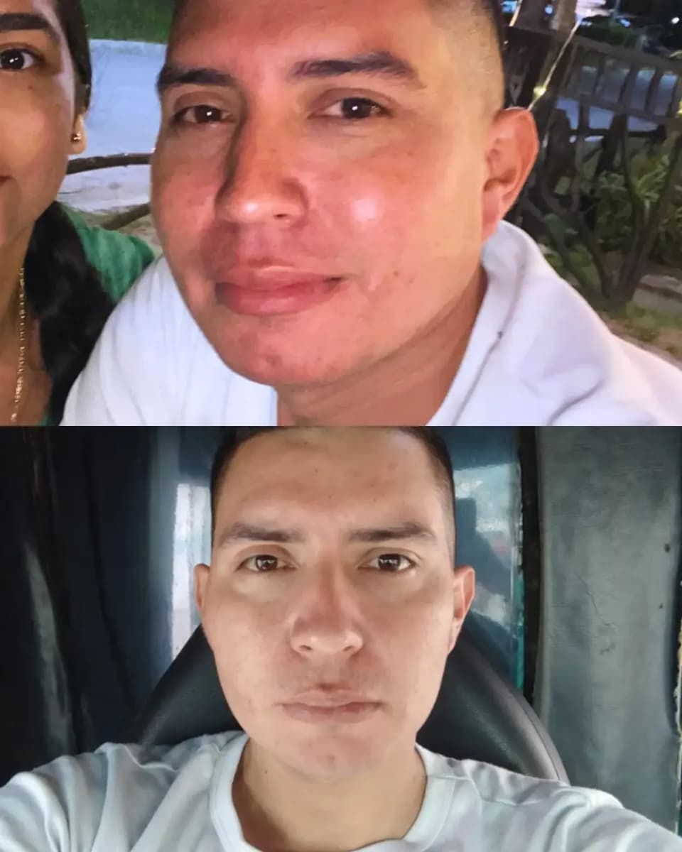 Yair before and after comparison showing visible changes in his skin