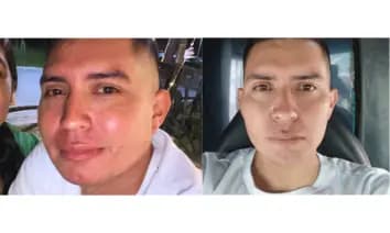 Antes y después real de una piel con rojeces y textura