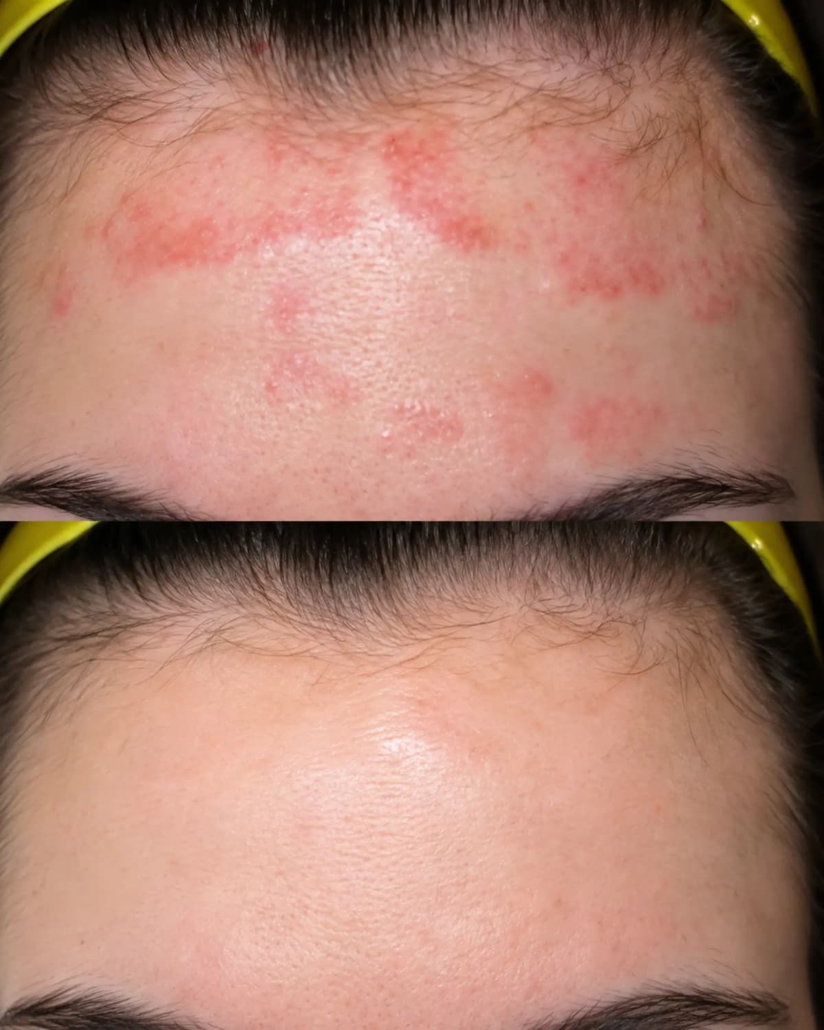 Experiencia real de piel con tendencia a dermatitis 2