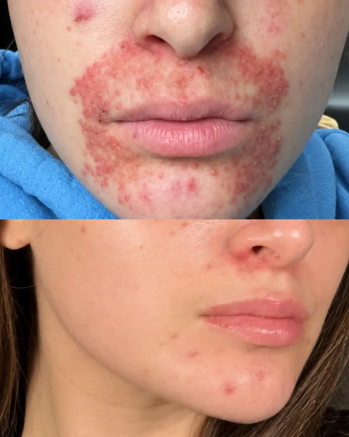 Experiencia real de piel con tendencia a dermatitis 3