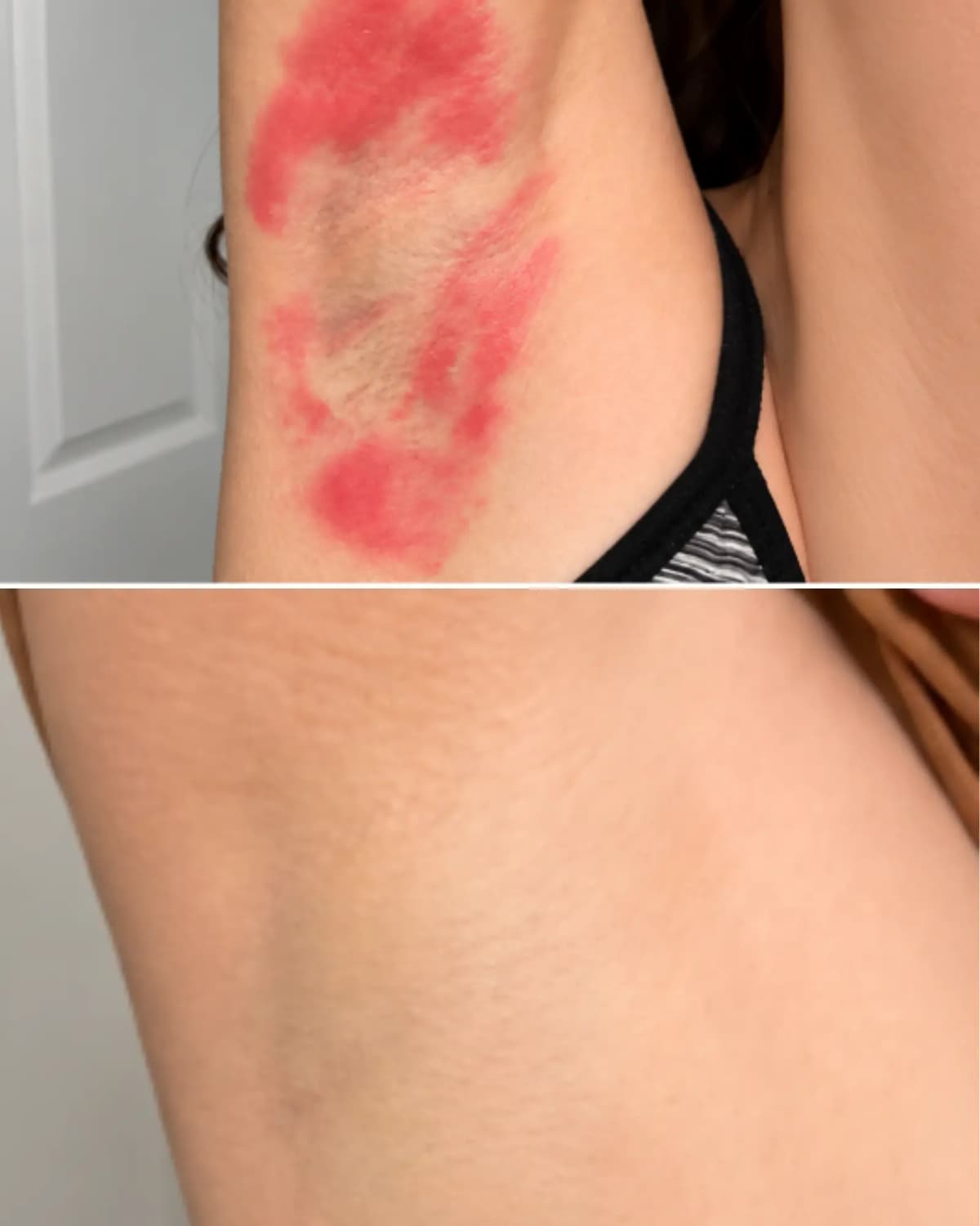 Experiencia real de piel con tendencia a dermatitis 5